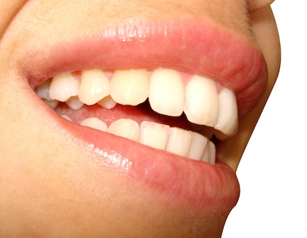 Close up of woman smiling with white teeth.